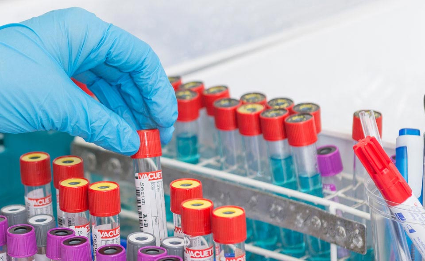 Biomedizinischer Analytikerin